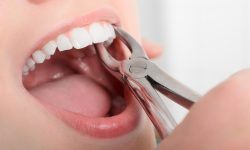 Business dentar! Un medic stomatolog a extras 4.000 de dinți sănătoși, ca să pună proteze scumpe